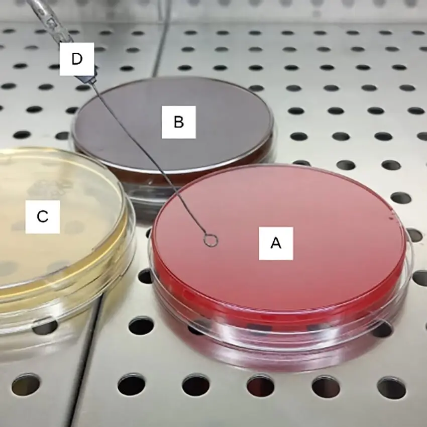 agar sangre agar chocolate - Cómo hacer un agar sangre