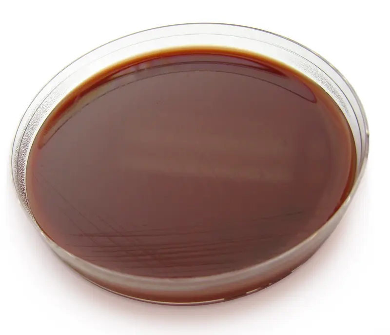 chocolate and antibiotics - Do sweets interfere with antibiotics