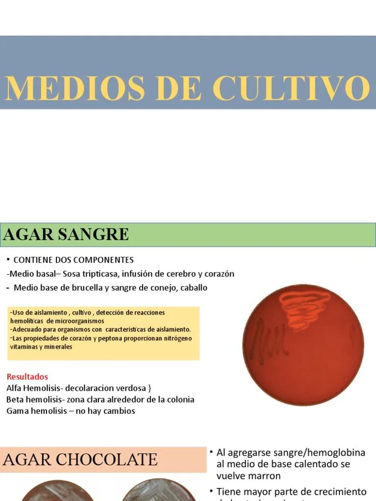 diferencia entre agar sangre y agar chocolate - El chocolate y el agar sangre son lo mismo