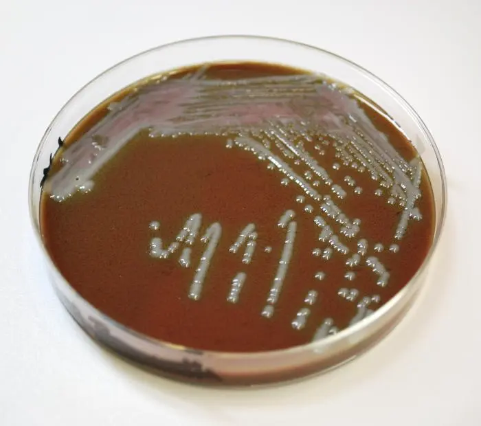 Cultivo de Haemophilus influenzae en agar chocolate: una herramienta esencial en el diagnóstico - Por qué Haemophilus influenzae crece en agar chocolate agar chocolate haemophilus influenzae - Por qué Haemophilus influenzae crece en agar chocolate