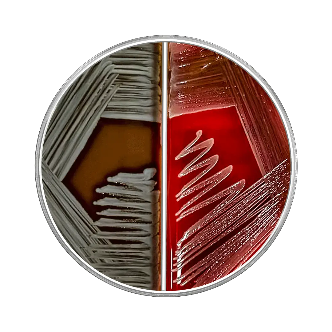 agar sangre agar chocolate - Qué es el agar sangre y para qué sirve