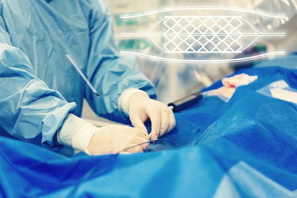 chocolate balloon angioplasty - What is the difference between angioplasty and ballooning